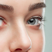Eyelid Aesthetics (Blepharoplasty) - Can Isler, MD.